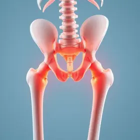 ajuda para prótese de artroplastia do quadril